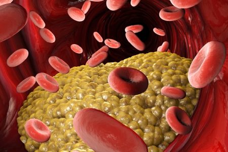 Acasti Pharma’s krill oil-derived drug fails late-stage study